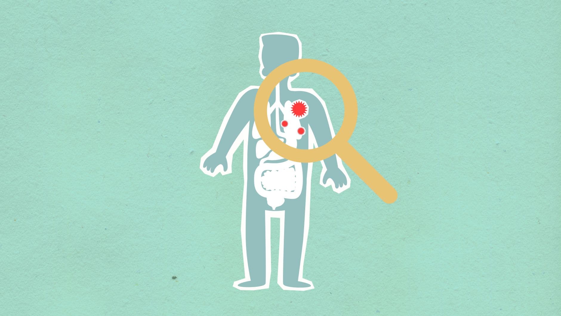 Costa Rica duplica sus casos de hepatitis A en 2026 y la Gran Área Metropolitana concentra el brote