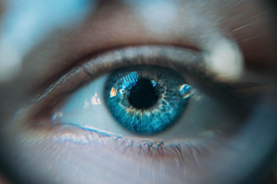 Detectan una marca en el rostro que anticipa el riesgo de infarto y ACV