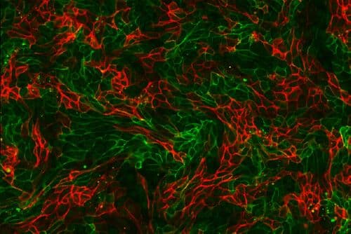 ¿El exceso de proteína puede dañar los riñones? Lo que realmente dice la ciencia