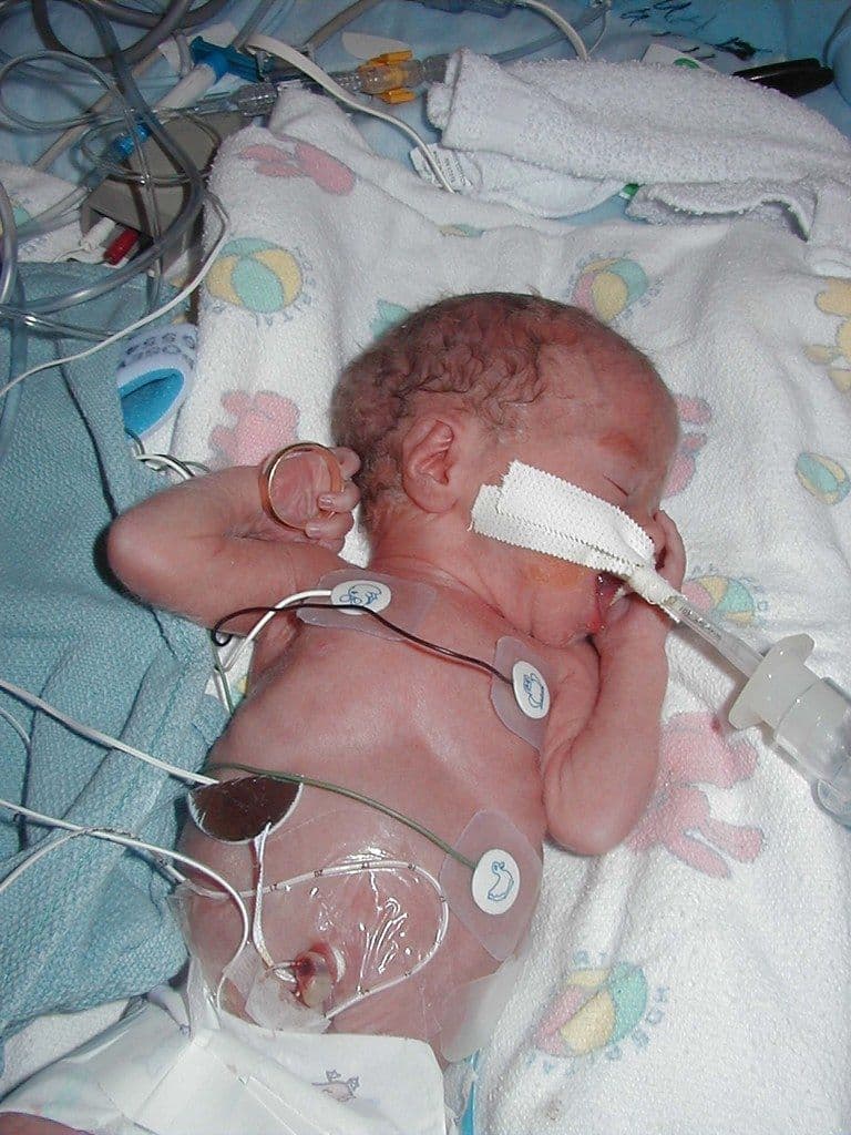 Un niño de 7 años con cardiopatía pidió ayuda al presidente y logró destrabar su tratamiento